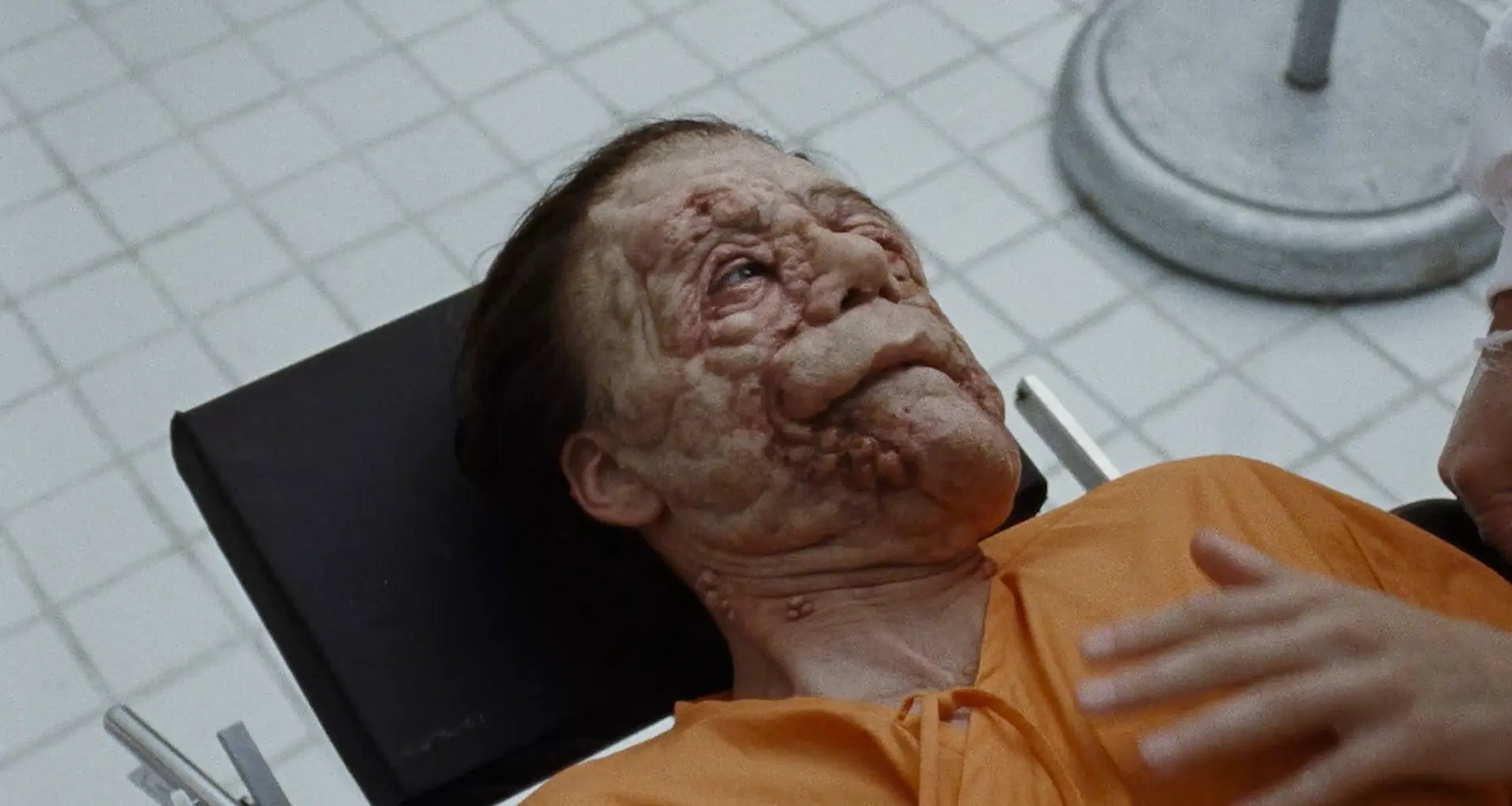 Edward (Sebastian Stan) prima del trattamento medico in A Different Man.