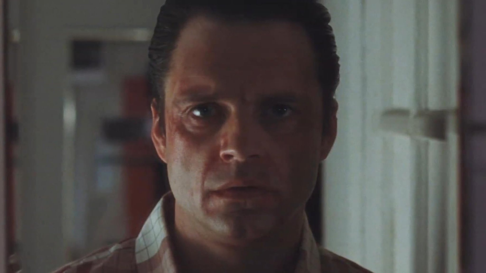 Edward (Sebastian Stan) e il suo nuovo volto in A Different Man.